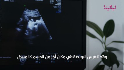 متى ينزل دم الحمل خارج الرحم