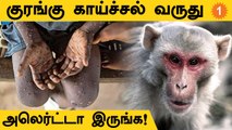 உலக நாடுகளில் அதிகரிக்கும் Monkeypox பாதிப்பு.. மத்திய அரசு எச்சரிக்கை #Health