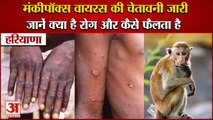 Haryana Government Alert Regarding Monkeypox Virus|हरियाणा में मंकीपॉक्स वायरस की चेतावनी जारी