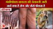 Haryana Government Alert Regarding Monkeypox Virus|हरियाणा में मंकीपॉक्स वायरस की चेतावनी जारी