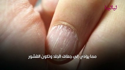 سبب تشقق الأظافر