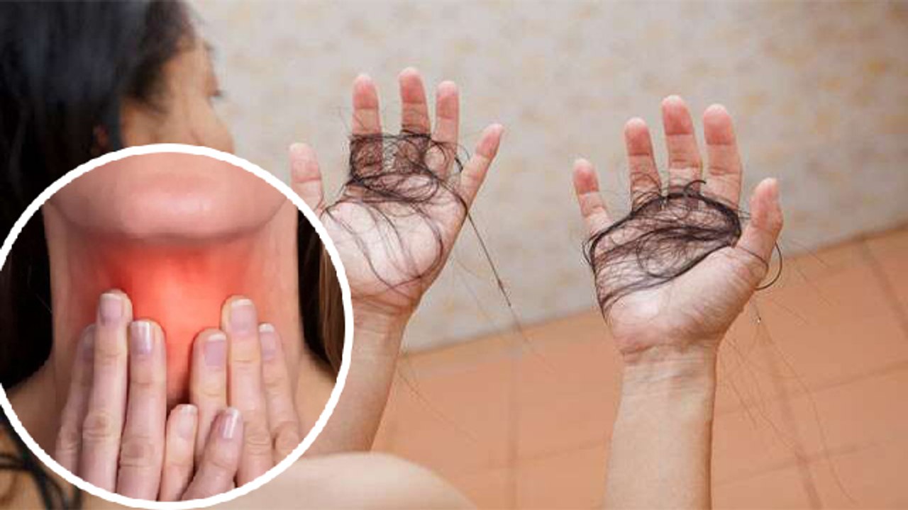 Hair Fall किस Vitamin की कमी से होता है Kis Vitamin Ki Kami Se Baal Jhadte Hain Boldsky