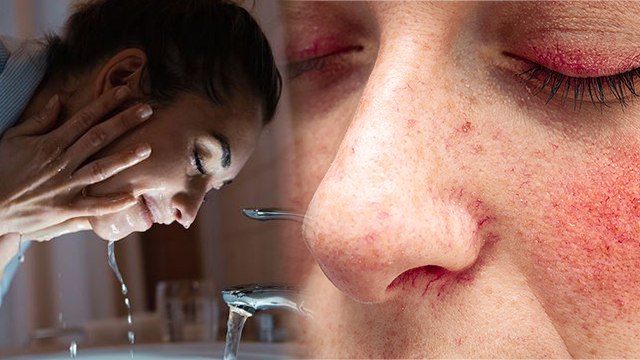 रात में चेहरा धोने से क्या होता है | Rat Me Face Wash Karne Se Kya Hota Hai | Boldsky