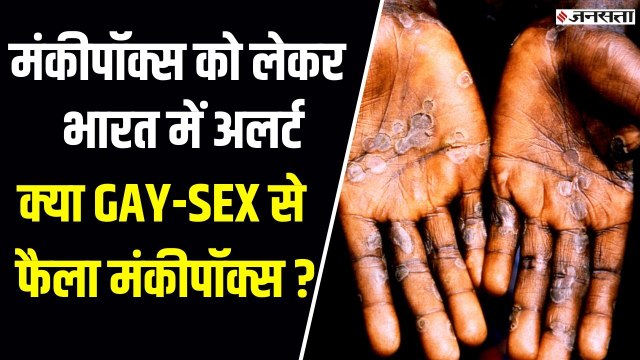 Monkeypox virus : भारत में मंकीपॉक्स को लेकर एडवाइजरी जारी, पश्चिमी देशों में तेजी से बढ़े मामले