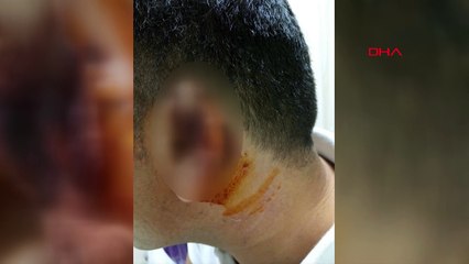 Kavgada ısırılarak koparılan kulağı martı kaptı