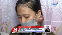 Ginang na 3 taon nang iniinda ang bukol sa kanyang tainga, nanawagan ng tulong | 24 Oras