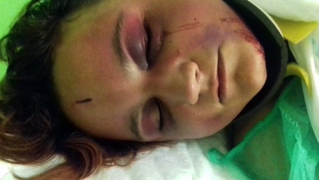 Si lanciò dal balcone per sfuggire al suo aguzzino: la nuova vita di Beatrice