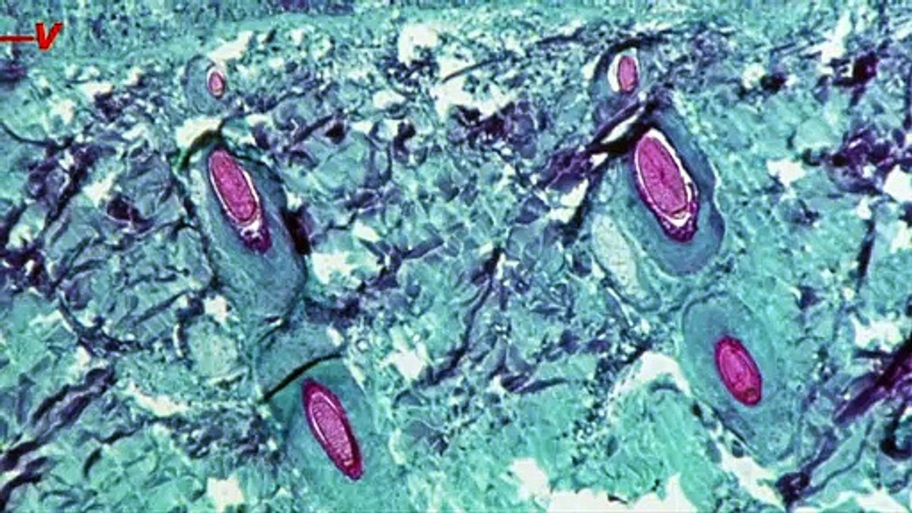 CDC Issues Monkeypox Warning to ‘Practice Enhanced Precautions’ When Traveling