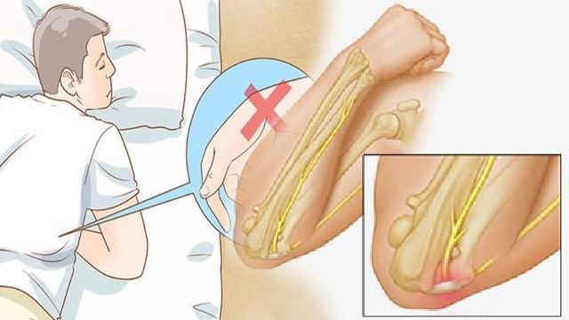 सोते समय हाथ सुन्न होना Paresthesia Symptom, चौंकाने वाला कारण और इलाज | Boldsky