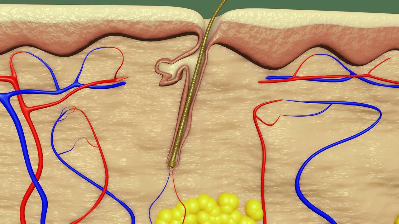 Kreisrunder Haarausfall | Immunsystem schuld am Haarausfall
