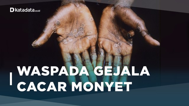 Mengenal Cacar Monyet, Wabah yang Berasal dari Afrika | Katadata Indonesia