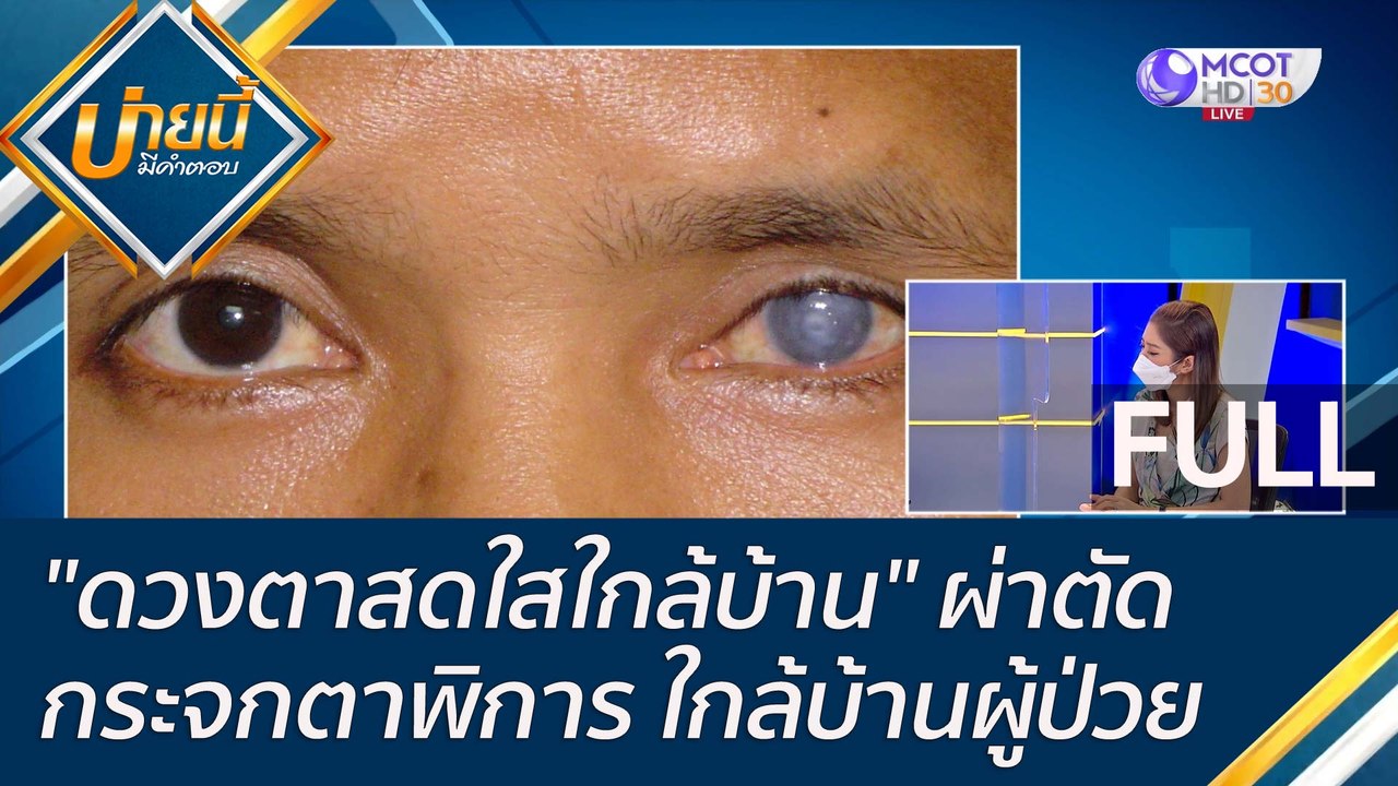 (คลิปเต็ม) "ดวงตาสดใสใกล้บ้าน" ผ่าตัดกระจกตาพิก...