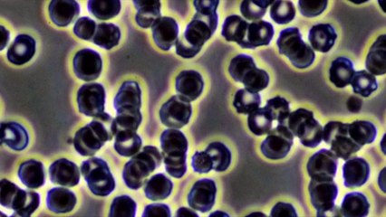 Effekte Von Clo2 Im Blut