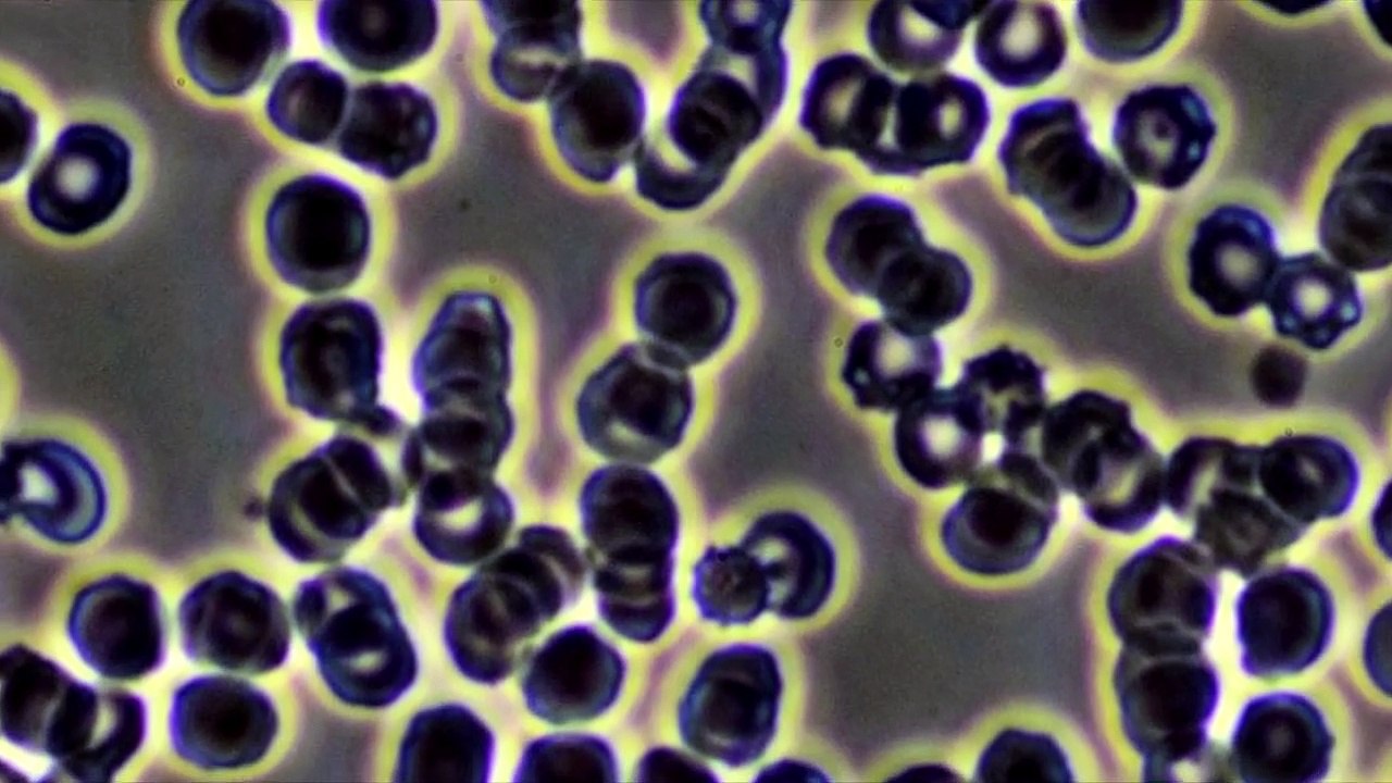 Effekte Von Clo2 Im Blut -1