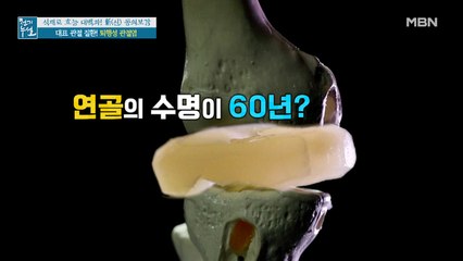 심뇌혈관 질환부터 정신적 문제까지! 전신건강 망치는 관절 질환