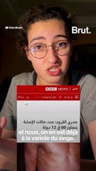 7 questions très simples sur la variole du singe