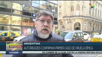 Ministerio de Salud confirma primer caso de viruela símica en Argentina