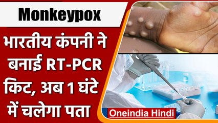 Monkeypox Virus India Update: Indian कंपनी ने बनाई RT-PCR Kit, 1 घंटे में चलेगा पता | वनइंडिया हिंदी
