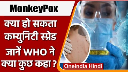 MonkeyPox News: दुनियाभर में बढ़ा MonkeyPox का खतरा,  WHO ने किया बड़ा खुलासा