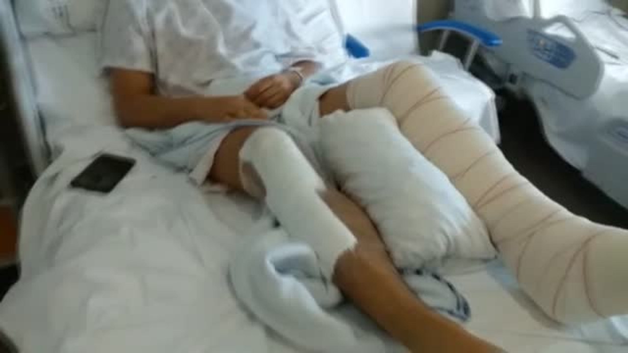 Buscan al conductor que huyó tras atropellar a un motorista en la autovía de Pontevedra