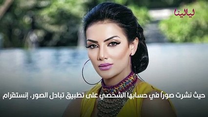 القصة الكاملة لأزمة حورية فرغلي.. بدءًا من حادث الحصان لعودتها لشكلها