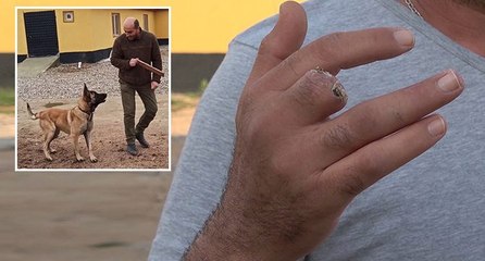Çitliğini korumak için aldı, az kalsın canından oluyordu: Orta parmağı koptu