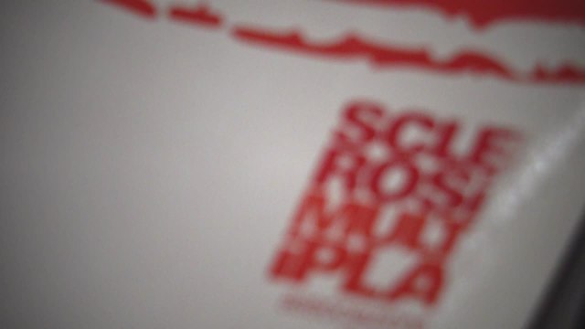 Sclerosi multipla, Battaglia (Fism): Compiuti grandi passi avanti nella ricerca