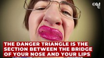 Danger triangle: Popping pimples on these parts of your face could cause brain infection