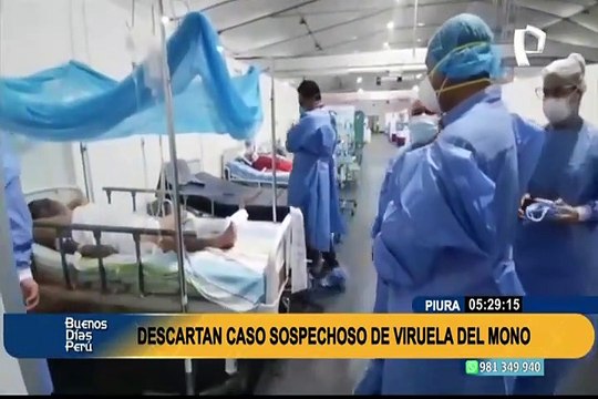 Viruela del mono: INS descarta que paciente sospechoso en Piura esté infectado con el mal