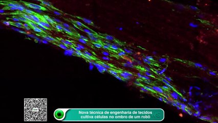 Nova técnica de engenharia de tecidos cultiva células no ombro de um robô