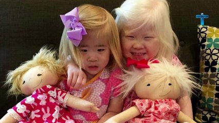 10 Rare Kids That Are One in a Million