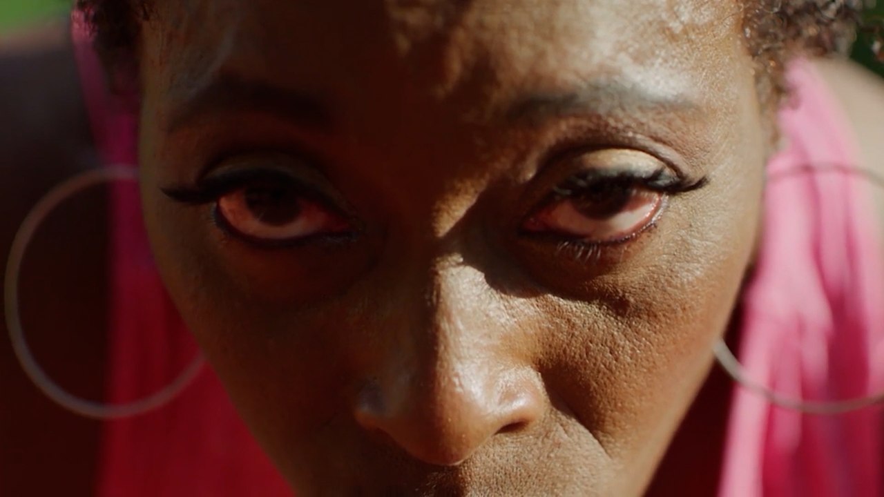 Olympic Gold Medalist Gail Devers on Thyroid Eye Disease video
