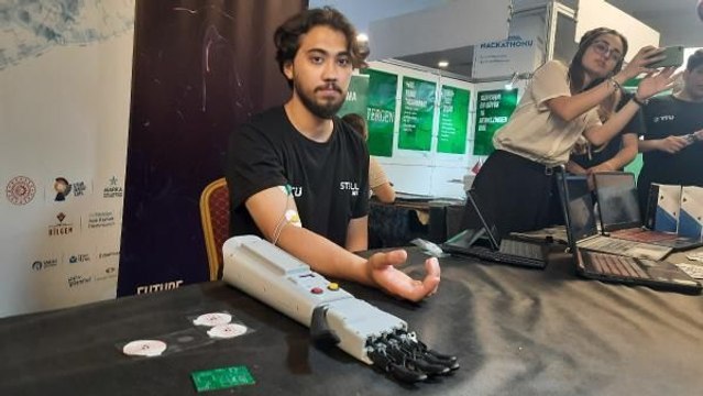 METRODA TEK KOLLU KIZDAN ETKİLENİP, BİYONİK KOL YAPTILAR