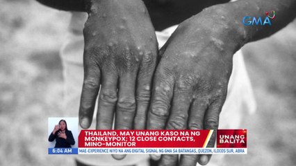 Thailand, may unang kaso na ng monkeypox; 12 close contacts, mino-monitor | UB