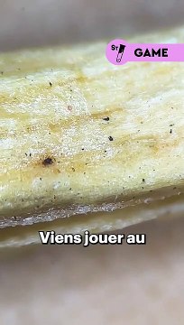 Devine ce qu’on te montre au microscope ! Go dans les commentaires donner ta réponse Indice : utile quand il n'y a pas de lumière