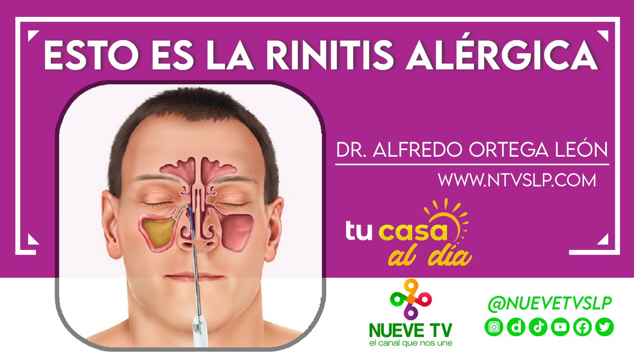 Esto es la rinitis alérgica