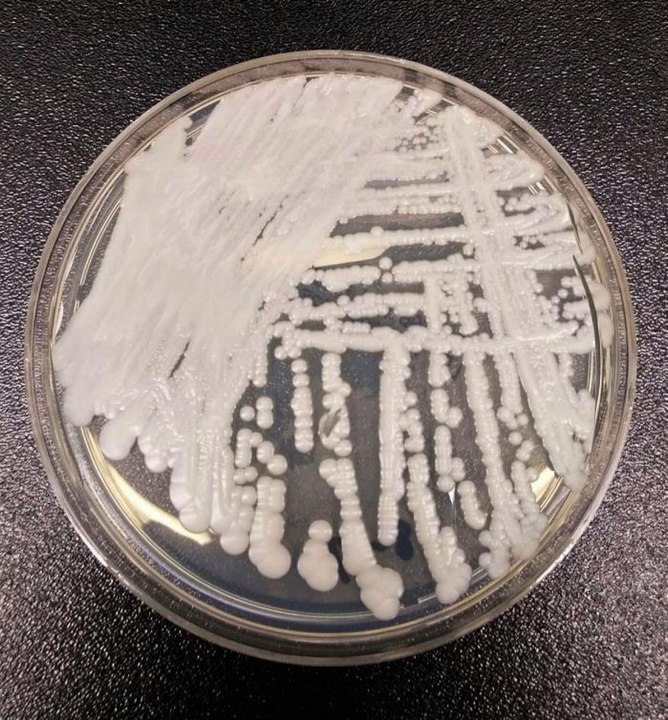 CANDIDA AURIS: saiba mais sobre surto do SUPERFUNGO em Pernambuco