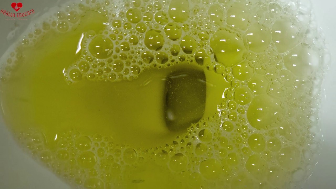 Proteinuria Treatment How to Lower Your protein in Urine video