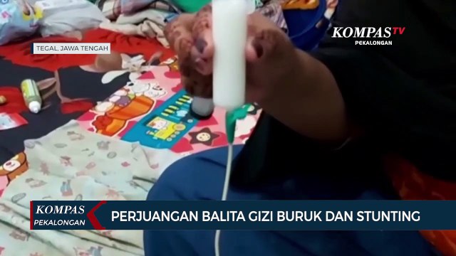 Balita Berusia 3 Tahun Mengalami Gizi Buruk dan Stunting