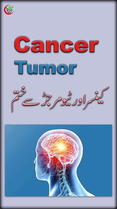 CANCER TREATMENT SHORT DETAIL VIDEO BY HAKEEM ABBAS ALI