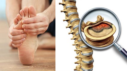 पैर सुन्न होना Spinal Cord Tumor Symptom, नजरअंदाज करने पर Paralysis का खतरा | Boldsky