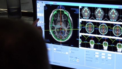 Shape of brain more signficant than previously thought