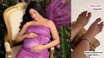प्रेगनेंसी में पैरों में सूजन क्यों आती है | Pregnancy Me Pairon Me Sujan Kyu Aati Hai | Boldsky