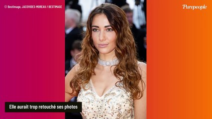 Delphine Wespiser accro à Photoshop ? "Elle a la faculté de plier sa jambe de l'autre sens !"