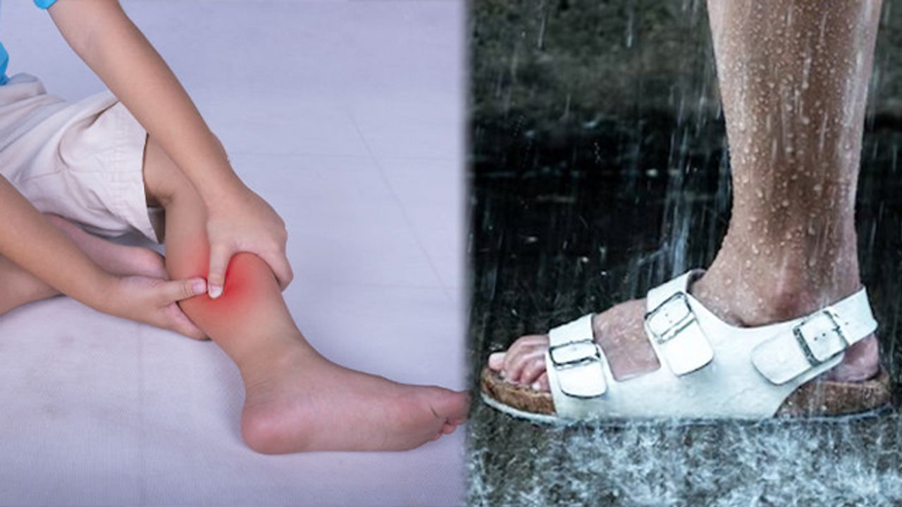 बारिश के दिनों में पैर दर्द क्यों होता है | Barish Ke Dino Me Pair Dard Kyu Hota Hai | Boldsky