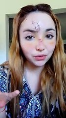 Salió a bailar, recibió un botellazo y le hicieron 14 puntos