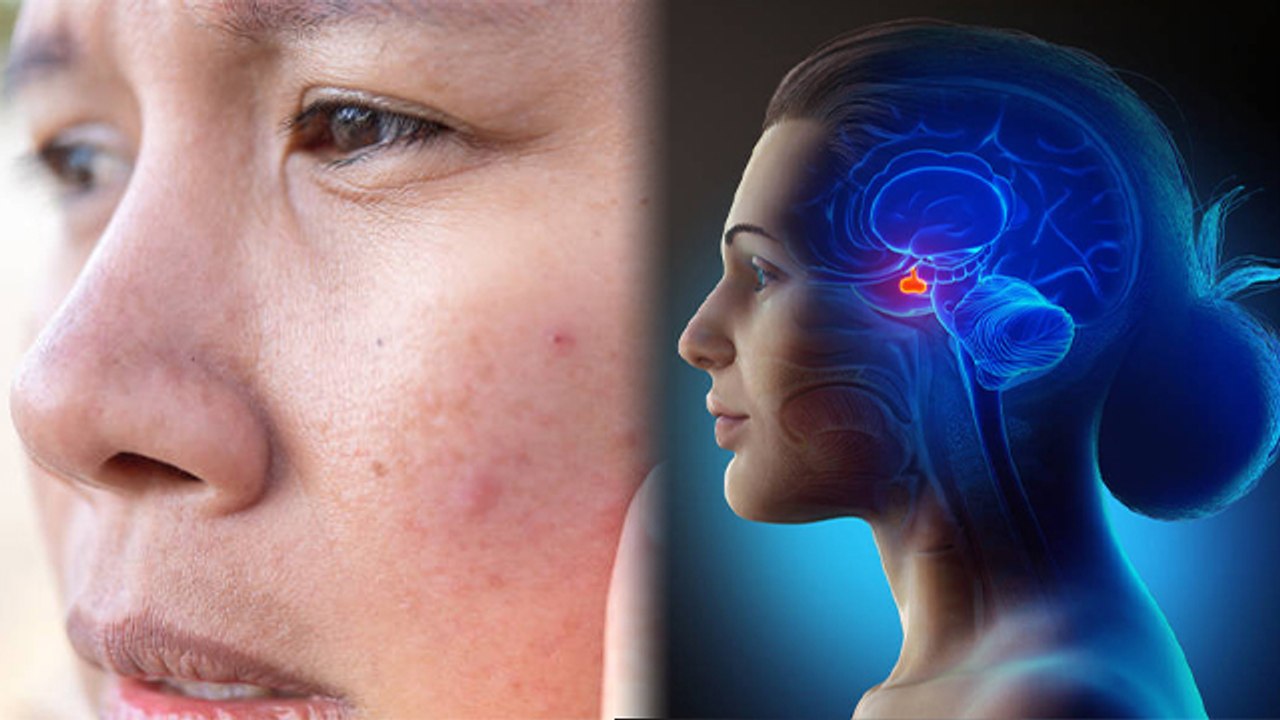 Face पर Dark Patches होना Oxidative Stress Symptoms, क्या है  Reason और  Treatment | Boldsky