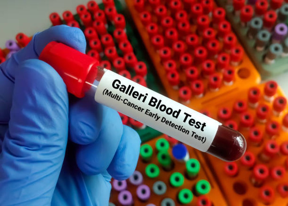 Nuevo Análisis De Sangre Capaz De Detectar 50 Tipos Distintos De Cáncer