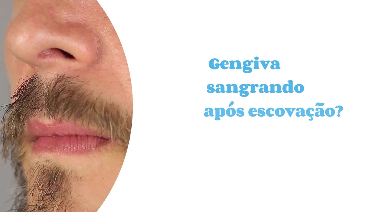 Gengiva sangrando após escovação? Saiba porque acontece e como evitar