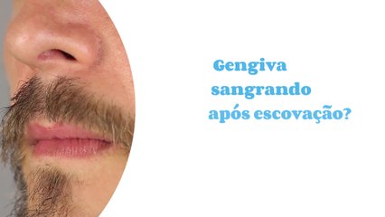 Gengiva sangrando após escovação? Saiba porque acontece e como evitar